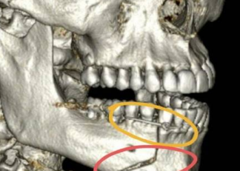 Justiça condena empresário e corretor por agressão a Henri Castelli e determina indenização de R$ 55 mil