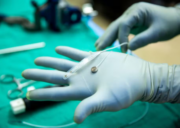 Nova rival de Musk testa chip cerebral em humano com sucesso em apenas 20 minutos!