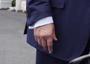 Trump é diagnosticado com insuficiência venosa crônica, diz Casa Branca
