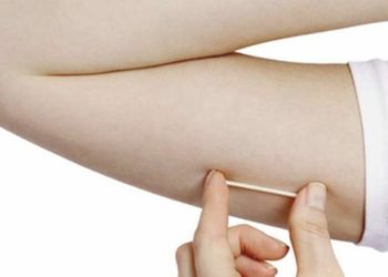 Implante contraceptivo de até R$ 4 mil que dura até três anos chega ao SUS